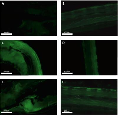 Metabolic Consequences of Developmental Exposure to Polystyrene Nanoplastics, the Flame Retardant BDE-47 and Their Combination in Zebrafish